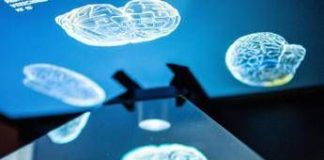 Tagliare le calorie può rallentare l’invecchiamento del cervello: ecco cosa dice lo studio