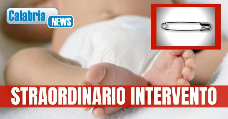 Bimba di 8 mesi ingoia spilla da balia: salvata all’Ospedale di Polistena