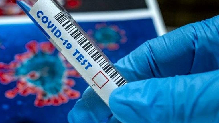 Covid Calabria: Una vittima e 421 nuovi casi, calano ricoveri e intensive. Pochi tamponi esaminati