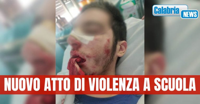 Studente aggredito da coetaneo al ‘Valentini-Majorana’ di Castrolibero: indagano i carabinieri
