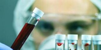 Emofilia, in Italia nuova soluzione sottocute giornaliera per pazienti con inibitori