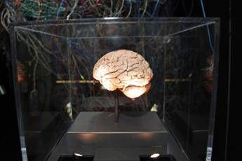 Medicina, neurologi: “L’innovazione può cambiare la storia di molte malattie ma serve equità”