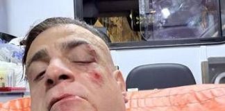 Cicalone, lo youtuber aggredito in metro a Roma: “Infami veri”