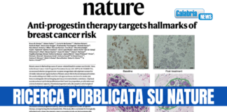 Ruolo chiave del gruppo Unical per una nuova terapia contro il tumore al seno