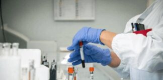 Alzheimer, allo studio nuovo test del sangue per diagnosi precoce