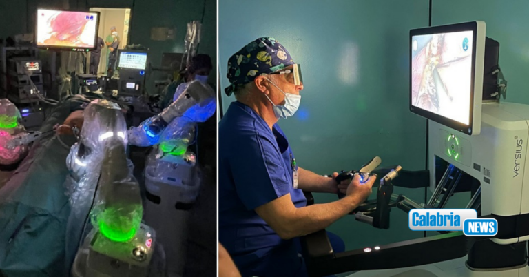 VIDEO-Sanità, a Lamezia debutta la chirurgia robotica di precisione con il sistema Versius