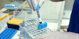 In Italia aumentano i casi di Epatite A: sotto osservazione anche il nord della Calabria