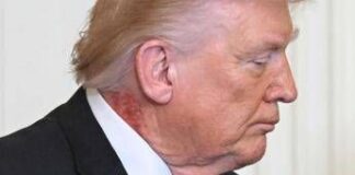 Trump e il collo arrossato, la foto riaccende i dubbi sulla salute del presidente