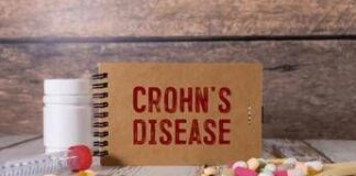 Malattia Crohn con fistole, nuovi dati su terapia monoclonale
