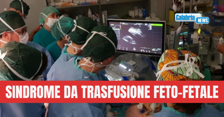 Tornati a Cosenza i due gemellini sottoposti a delicato intervento di chirurgia fetale al Policlinico di Milano